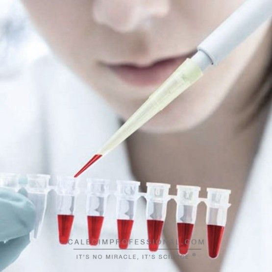 CalecimProUK's tweet photo. Plant stem cells vs Cord Lining Stem Cells. Know the difference to find out which stem cell product is for you. https://t.co/r4eLRg23GA https://t.co/nZg5YF0VOm