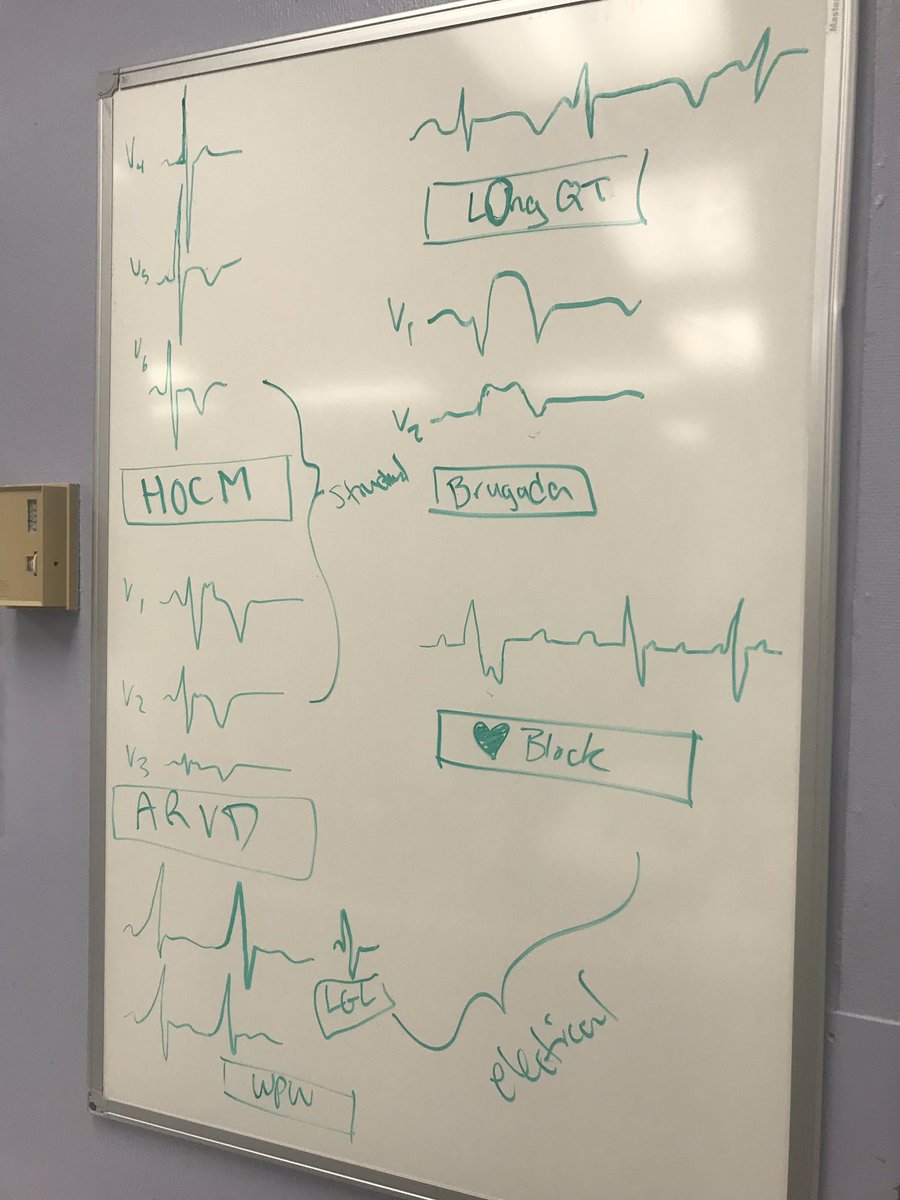 jacksonmiamiEM's tweet photo. Got a patient with syncope? Dr. Traum says: Make sure to check that EKG for all these life-threatening causes #WhiteBoardTeaching #ITEprep #ECG https://t.co/rEX9K2PeI7