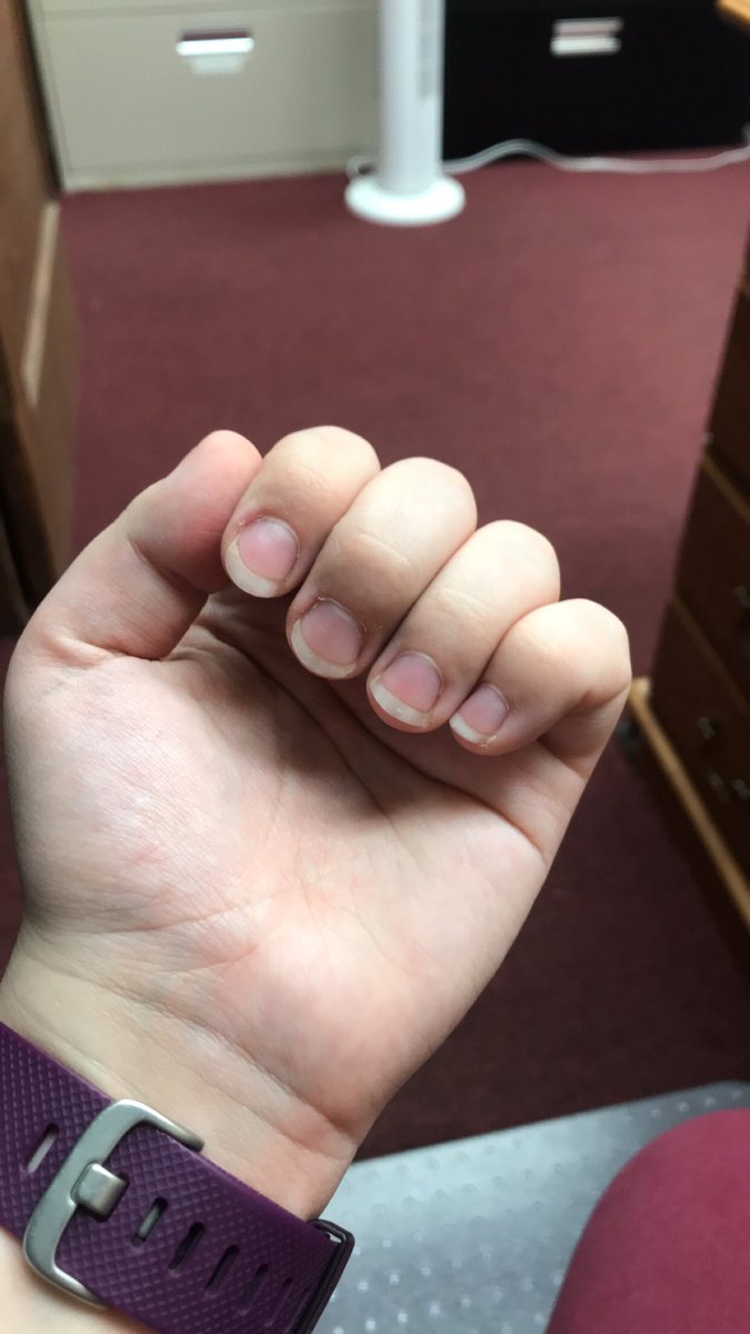 PrissyPandora's tweet photo. I want to get my nails done today for my birthday next week 💅🏻

$end and make it happen 😘

#findom #finsub #paypig #humanatm #payup #fdds @RtBitch25 @RTPiggyy @rtfemdom1 @GirlRtPromo @rtslut101 @rtfindo @RT4fet @RTPromoPig8 https://t.co/J1Mtcovkvx