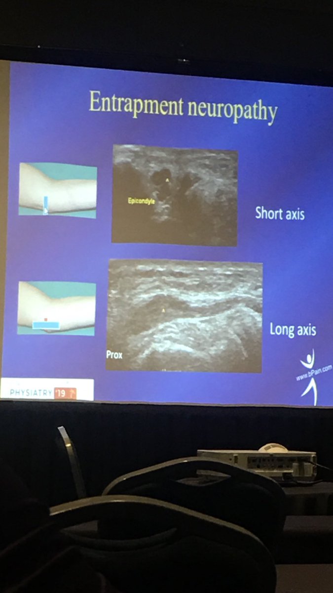 MelanieM555's tweet image. Excellent talk on the emerging use of ultrasound in peripheral nerve diagnostics #Physiatry19 @AAPhysiatrists #puertorico