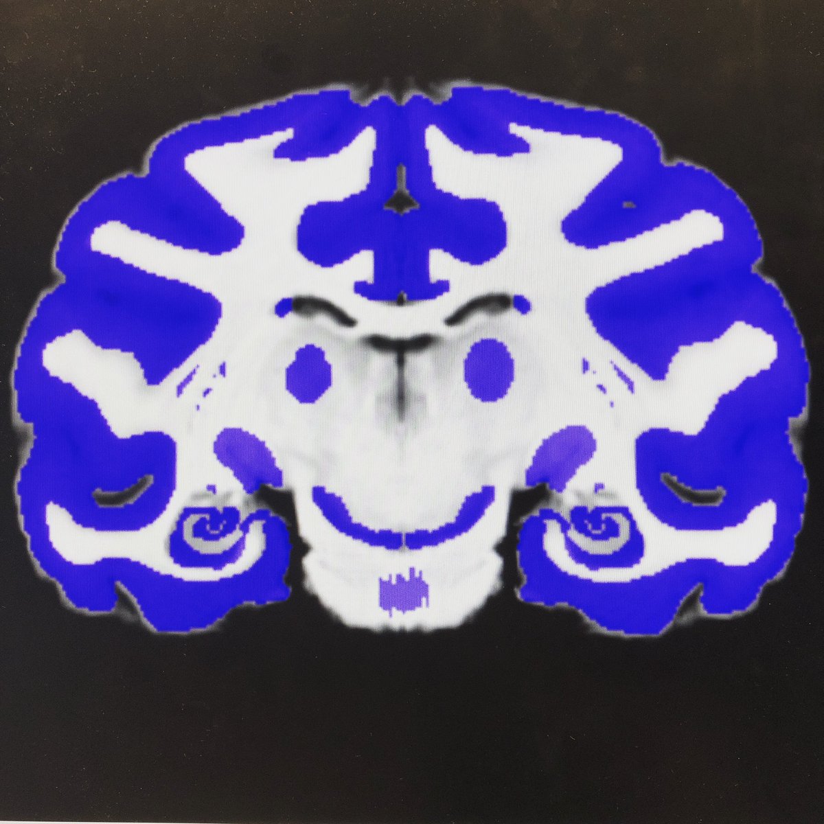 HartigRenee's tweet photo. The regions-of-interest look like a mans with a goatee and the hippocampus are his curls #fridaynightscience #D99 #macaque #neuroscience #tuebingen https://t.co/cEu3N9fthh