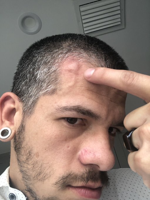 I took a Hit at work.. https://t.co/8NiHRtXGSv<a href="/tag/blackmonday"class="tags"><span>#blackmonday</span></a>