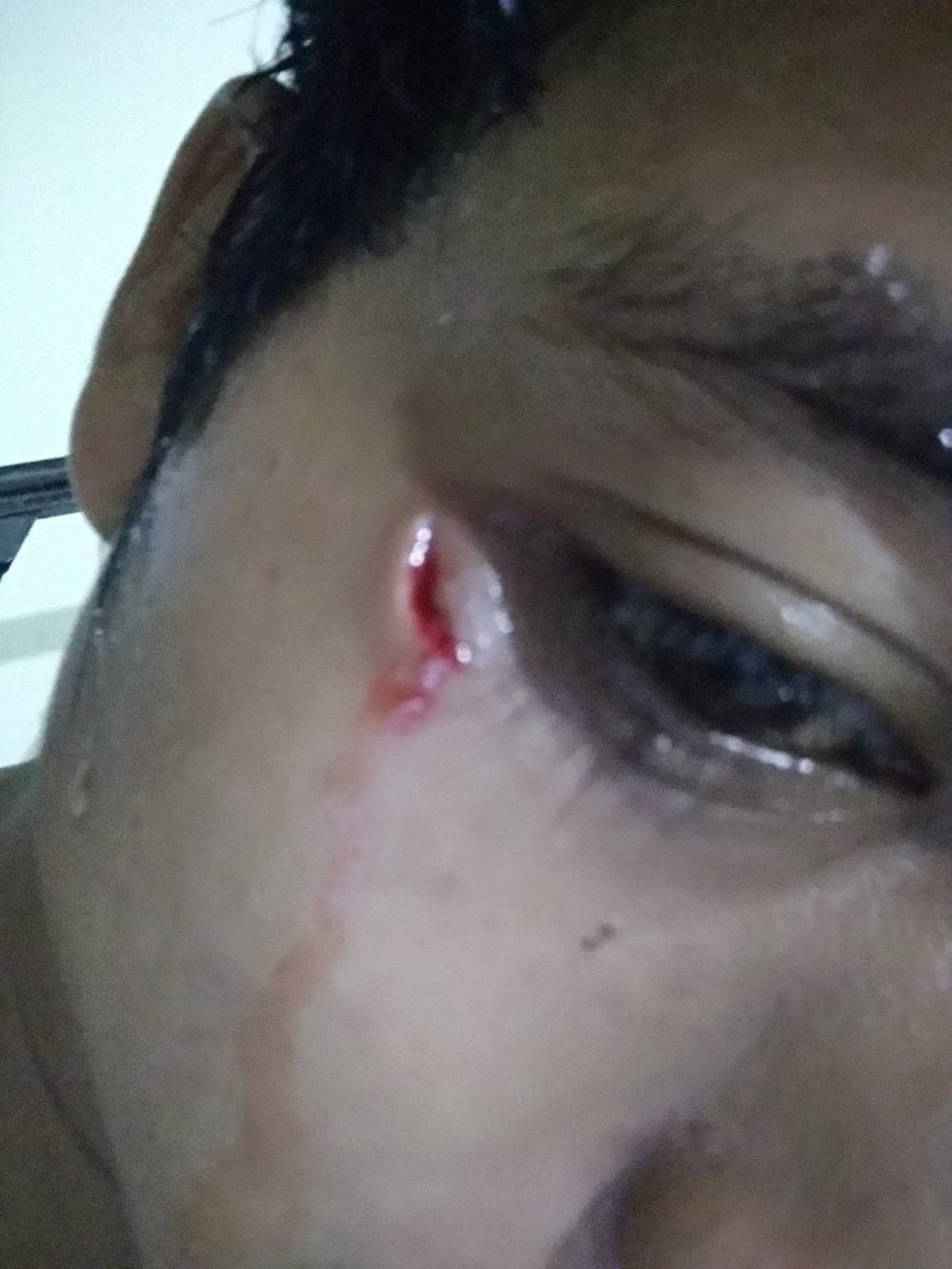 Baink_Rahil tweet picture