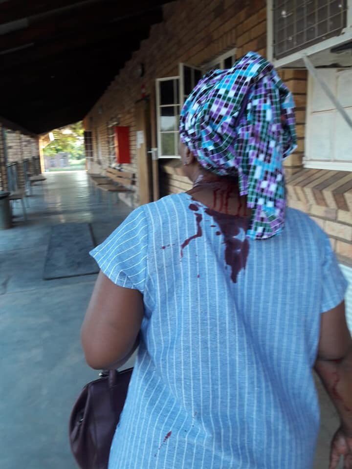 AdvoBarryRoux's tweet photo. That Lady is a teacher from a Village Called Tlhatlaganyane in Rustenburg. She was attacked by a parent for not allowing her child to go to toilet. https://t.co/Chr5ZQKaud