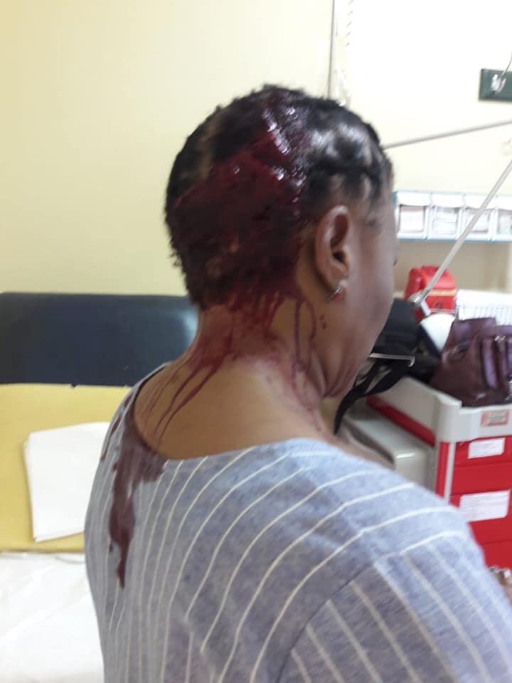 AdvoBarryRoux's tweet photo. That Lady is a teacher from a Village Called Tlhatlaganyane in Rustenburg. She was attacked by a parent for not allowing her child to go to toilet. https://t.co/Chr5ZQKaud