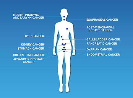 aicrtweets's tweet photo. Over the past four decades, the global prevalence of having excess body weight has roughly doubled, from 21 percent in men and 24 percent in women to 40 percent in both sexes. https://t.co/ADJVf6YWl1 #CanPrevent #CancerPreventionMonth https://t.co/zSZ1vtlAmT