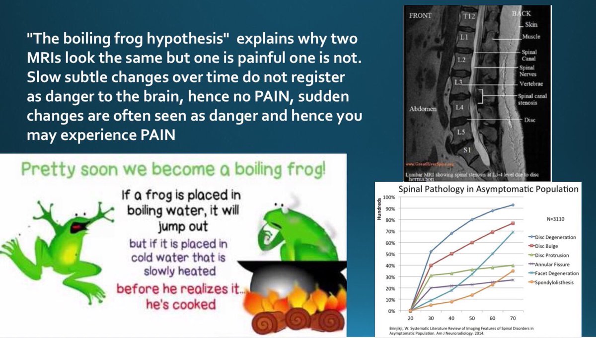 Retlouping's tweet image. History of onset is important in these cases. Sudden onset versus slow progressive onset.  The red flag cases are usually the sudden onset and progress quickly to an emergency case. Slow progressive is not a sudden emergency presentation. Boiling frog model.