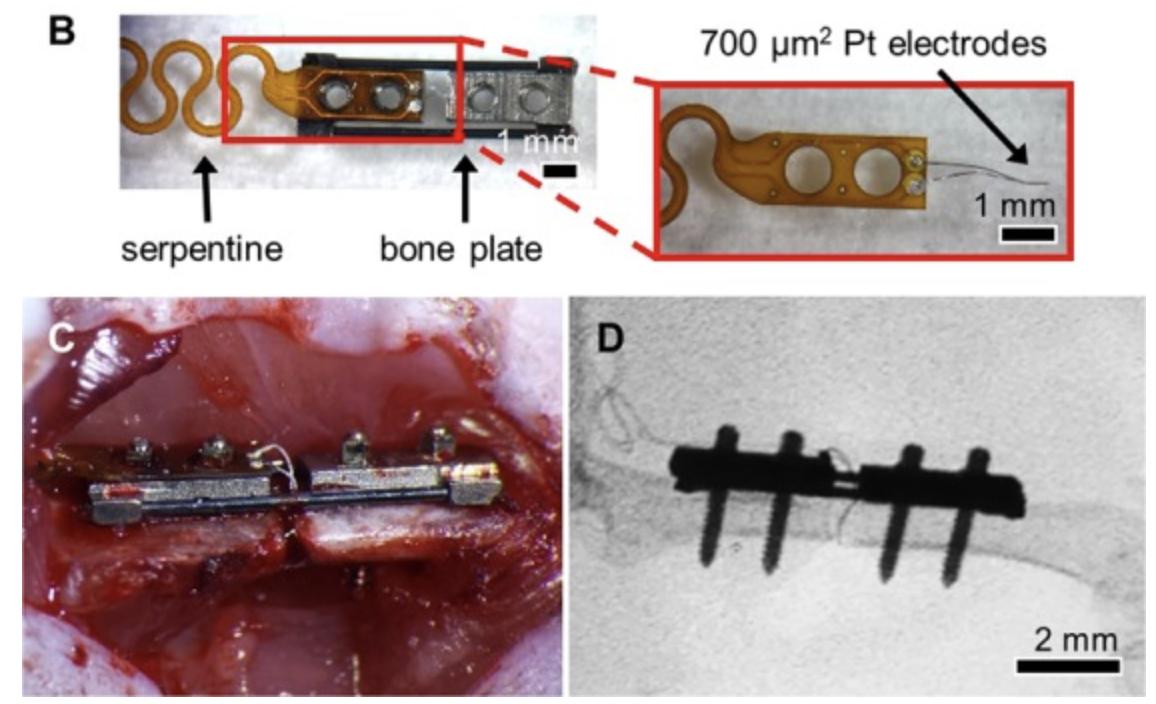 Robert Zondervan, DO, PhD (@robzondervan) on Twitter photo #FractureFriday Amazing paper by Dr. Monica Lin and <a href="/BahneyOrthoLab/">Chelsea S Bahney</a> et al. on post-operative #fracture monitoring utilizing electrical impedance spectroscopy (EIS). @nature ncbi.nlm.nih.gov/pubmed/30765721
<a href="/ORSsociety/">Orthopaedic Research Society</a> <a href="/isfrfractures/">ORS ISFR</a> <a href="/TheGoldenTibia/">Golden Tibia</a> #FractureFriday Amazing paper by Dr. Monica Lin and <a href="/BahneyOrthoLab/">Chelsea S Bahney</a> et al. on post-operative #fracture monitoring utilizing electrical impedance spectroscopy (EIS). @nature ncbi.nlm.nih.gov/pubmed/30765721
<a href="/ORSsociety/">Orthopaedic Research Society</a> <a href="/isfrfractures/">ORS ISFR</a> <a href="/TheGoldenTibia/">Golden Tibia</a>