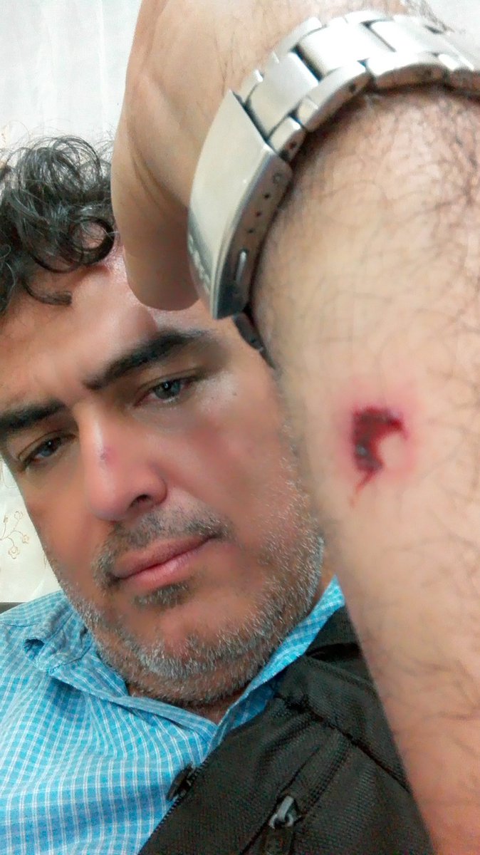 LDanieri's tweet photo. ESTOY BIEN

La GN disparó perdigones a un grupo desarmado, yo entre ellos. Vi al funcionario apuntar, hasta halar el gatillo, me pareció algo criminal hacer eso contra personas desarmadas que buscaban sólo dialogar. Gracias estoy bien Gracias a Dios #Venezuela #Tachira #23Feb https://t.co/AmHuwlW0Jx
