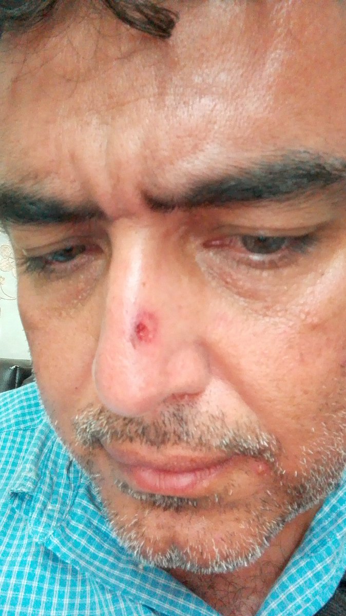 LDanieri's tweet photo. ESTOY BIEN

La GN disparó perdigones a un grupo desarmado, yo entre ellos. Vi al funcionario apuntar, hasta halar el gatillo, me pareció algo criminal hacer eso contra personas desarmadas que buscaban sólo dialogar. Gracias estoy bien Gracias a Dios #Venezuela #Tachira #23Feb https://t.co/AmHuwlW0Jx