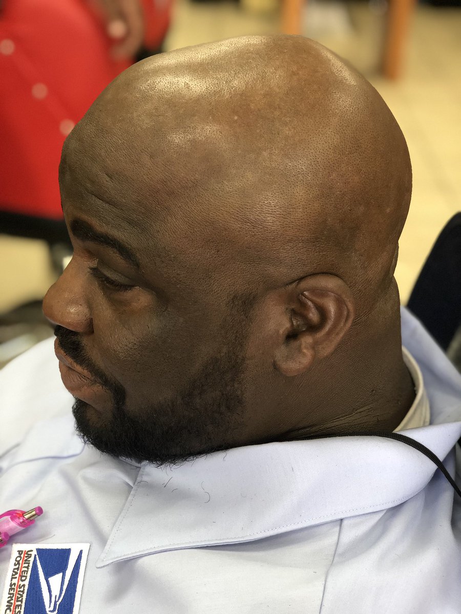 StarrMillz's tweet image. Oh I’m wit it!!! What u saying?!?! Come get these Bald 👨🏾‍🦲 cuts and these line ups! Check me out. Got his beard in order.  #baldcut #baldcuts #haircut #haircutsmiami #miamicuts #femalebarber #miamihairstylist #hairstylist  #beautyschoolofamerica @beautyschoolsofamerica