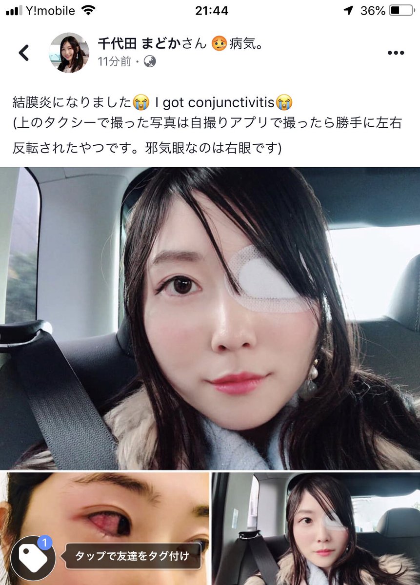 O Xrhsths ちょまど Ms入社5周年嬉しい Sto Twitter Facebook に結膜炎になったと眼帯の写真を投稿したら 海外の アニメオタクの知人から 東京喰種 の金木くん 眼帯キャラ の写真が送られて来た O Xrhsths ちょまど Ms入社5周年嬉しい Sto Twitter Facebook に結膜炎になったと眼帯の写真を投稿したら 海外の アニメオタクの知人から 東京喰種 の金木くん 眼帯キャラ の写真が送られて来た