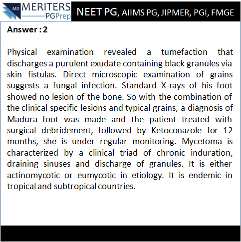 pg_prep's tweet photo. What is your diagnosis?
1. Charcot´s foot
2. Mycetoma pedis
3. Bowen´s disease
4. Kaposi sarcoma 
.
.
#NEET_PG #AIIMS #JIPMER #PGI #DNB #Medicine #PG_Medical_Entrance #NEETPG #MedicalEntrance #Doctor #Medical #PGPrep #ImageMCQs #NEET_Mock_Test #Anaesthesia #Biochemistry #ENT https://t.co/bcEVl0vb5N