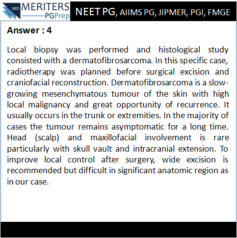 pg_prep's tweet photo. What is your diagnosis?
1. Cutaneous Melanoma
2. Keloid and Hypertrophic Scar
3. Dermatofibroma
4. Dermatofibrosarcoma
.
#NEET_PG #AIIMS #JIPMER #PGI #DNB #Medicine #PG_Medical_Entrance #NEETPG #MedicalEntrance #Doctor #Medical #PGPrep #ImageMCQs #NEET_Mock_Test #Anaesthesia https://t.co/p3b6GsMKOA