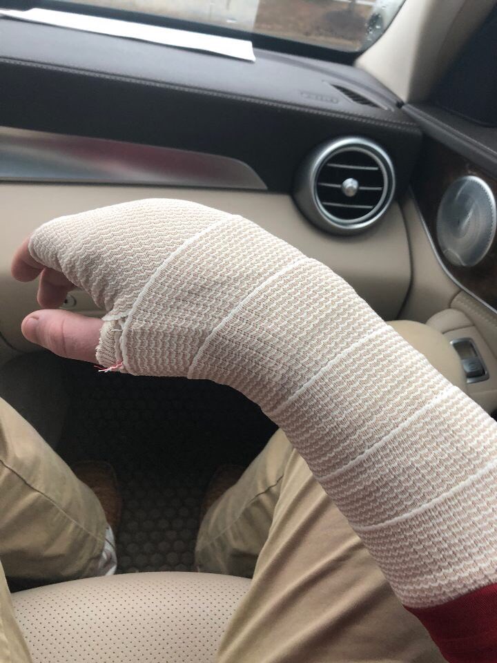 JDevelopmental's tweet photo. Due to a freak accident regarding his reflection, SG Chandler “JET” Copeland is out for the season with a broken hand. Praying for a speedy recovery, 39. https://t.co/z5gMrONJCA