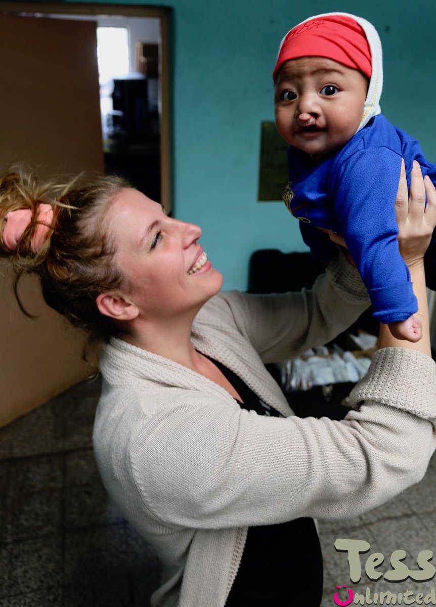 TessUnlimited's tweet photo. Day 2 is done! Triage day AND 10 surgeries! YES! #surgeryweek #day2 #plasticsurgery #cleft #guatemala #smilemakers #everysmilehasastory #smiletrain #weloveresults #missionwork #jointhemission #changealife #excited #whywegetupthemorning https://t.co/eIIvSO6gq0
