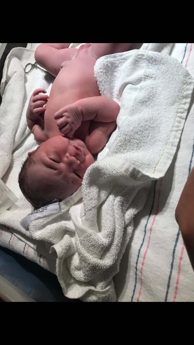 jairaaaaw's tweet photo. Well worth the pain. I LOVE YOU MY BABY😘💕 02.24.19 https://t.co/7KYhSEDzYR