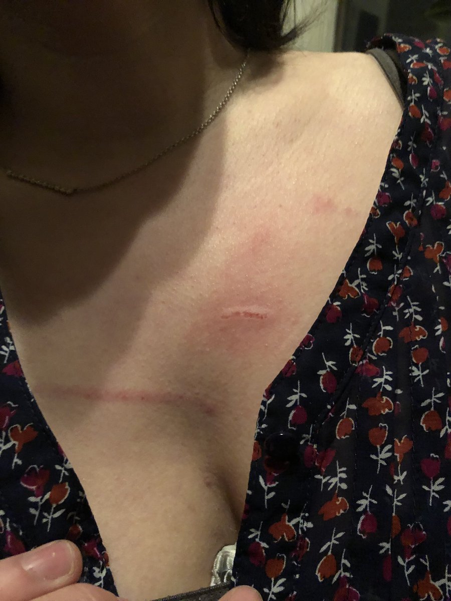 throwdembows's tweet photo. @tacobell 1037 chestnut. Phila pa. Your employees jump counters and beat up customers in the street. https://t.co/D5BQE7H5oV