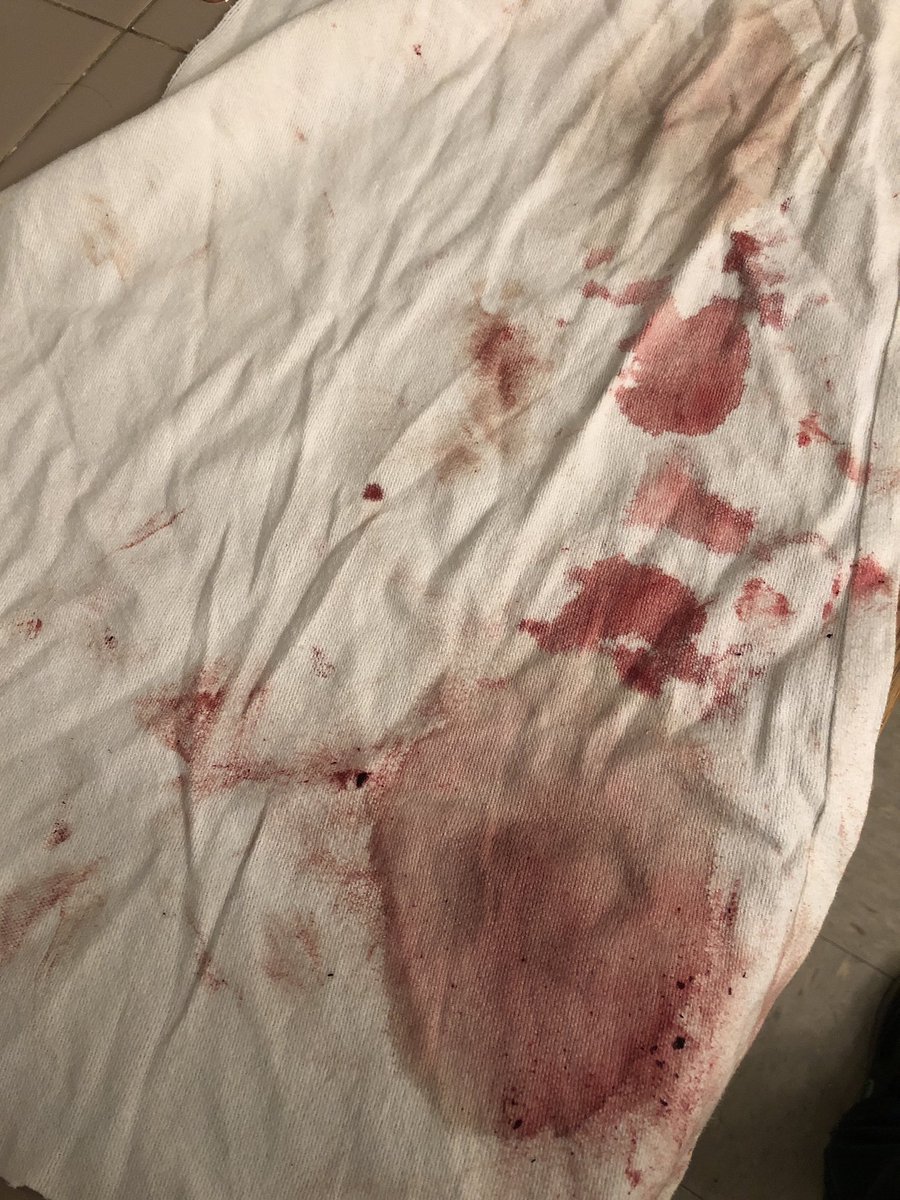 throwdembows's tweet photo. @tacobell 1037 chestnut. Phila pa. Your employees jump counters and beat up customers in the street. https://t.co/D5BQE7H5oV