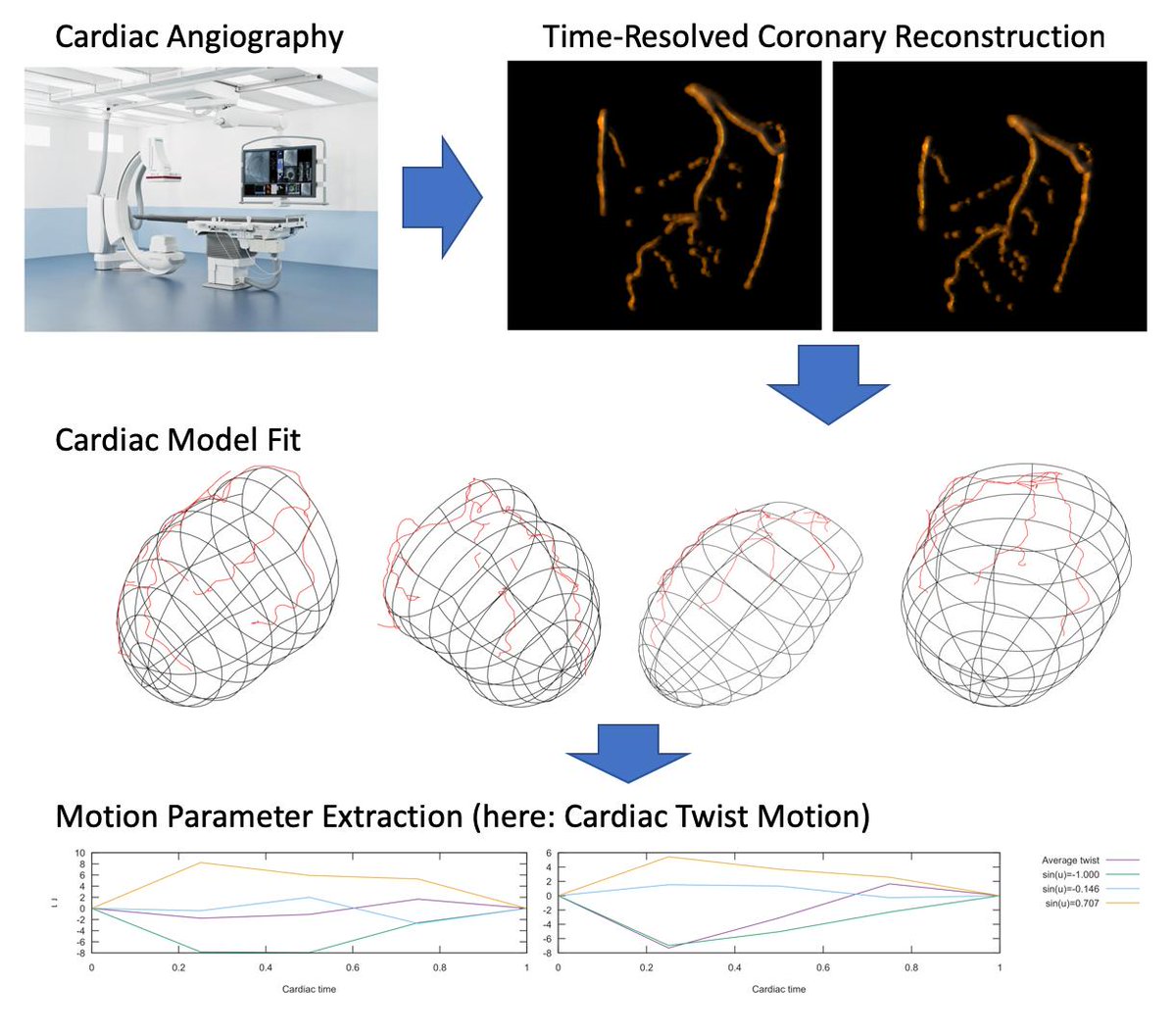 maier_ak's tweet photo. Can we extract complex cardiac motion parameters from coronary angiography? Tobias Geimer, @MathiasUnberath, and Johannes Höhn think so and present the first two clinical cases.
#freeaccess link:
https://t.co/JZ7hhczxy8
@FAU_Germany #nodeeplearning #radiology @BVM_Community https://t.co/ON9OlCidnE