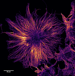 EdinUniImaging's tweet photo. Event: Demonstration of the Re-scan Confocal Microscope (RCM) - held in QMRI, Edinburgh - 5 March for demo. https://t.co/zC0XX1ipWo #laser2000 #microscopy https://t.co/HYoWUFLEld