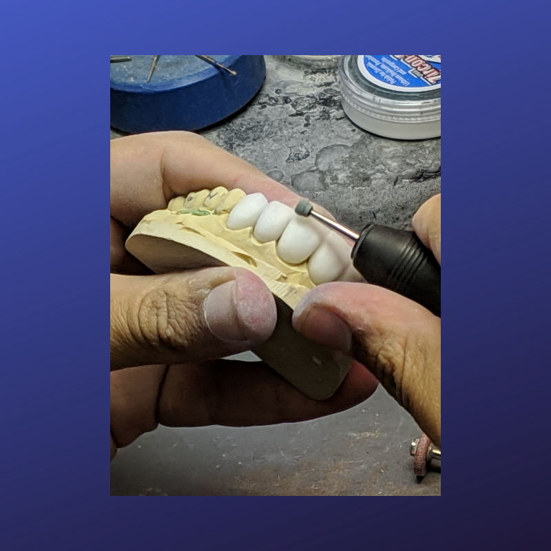 Technics Dental Lab on Twitter "Shaping the porcelain to give the