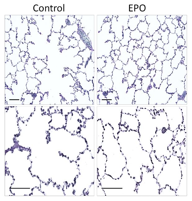 AJPLung's tweet photo. New #ResearchArticle in AJP-Lung: “Erythropoietin inhalation enhances adult canine alveolar capillary formation following #pneumonectomy“.
Read more here: https://t.co/qU2C1974lY
#LungFunction #Morphometry https://t.co/Og9ORHOuil