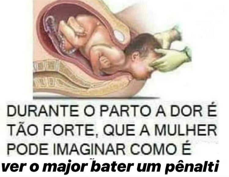 MemesOfJaco's tweet image. Trago a vocês a realidade !!
