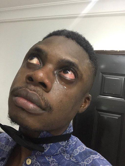 Viktoh_TM's tweet image. Knowing we'll have to endure Buhari for another 4 years.. #pollstream #theverdict #2019elections