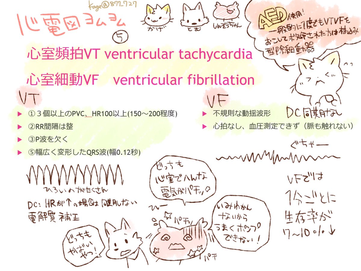看護師のかげさん イラスト看護帖書籍化 心電図ヨムヨム講座 Vt Vf Vtの場合はすぐに脈ありか なしかを確認する Torsades De Pointesは突然死のリスクあり 低カリウム 低マグネシウム血症などの電解質異常が原因なことも この二つだけはナース