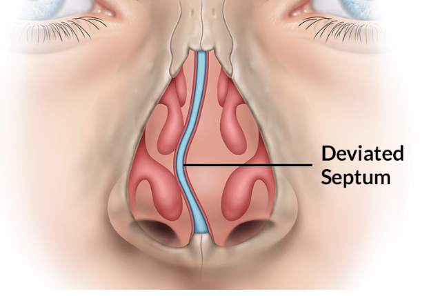 3DPrintBureauUK's tweet image. Researchers at St. Mary’s Hospital in Seoul, South Korea, have applied 3D printing to the treatment of a condition that can cause respiratory problems and sleep disorders. Read more here - bit.ly/2StTIYG #3dprinting #medical #mectech #3dprint