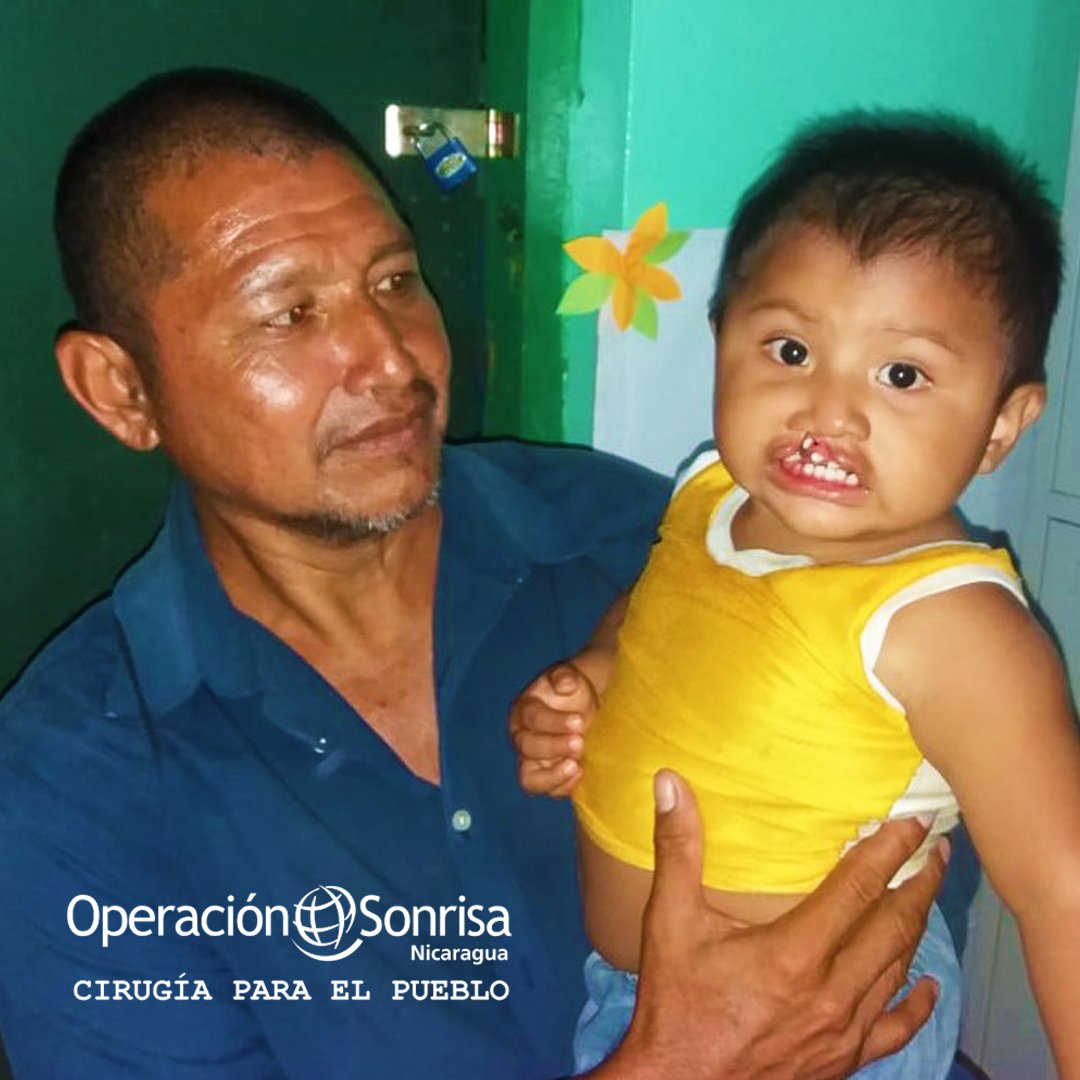 OSN_CPEP's tweet photo. Desde la comunidad de Walanwas, a dos días de camino, se presentó don Pedro Alemán con su hijo Elvin de 18 meses en las oficina regional de Bonanza, para obtener cita médica con @OS_nicaragua . Fue atendido por nuestra Coordinadora de Pacientes, Margory Tilleth.
#cpep #osn #smile https://t.co/UuLats5t15