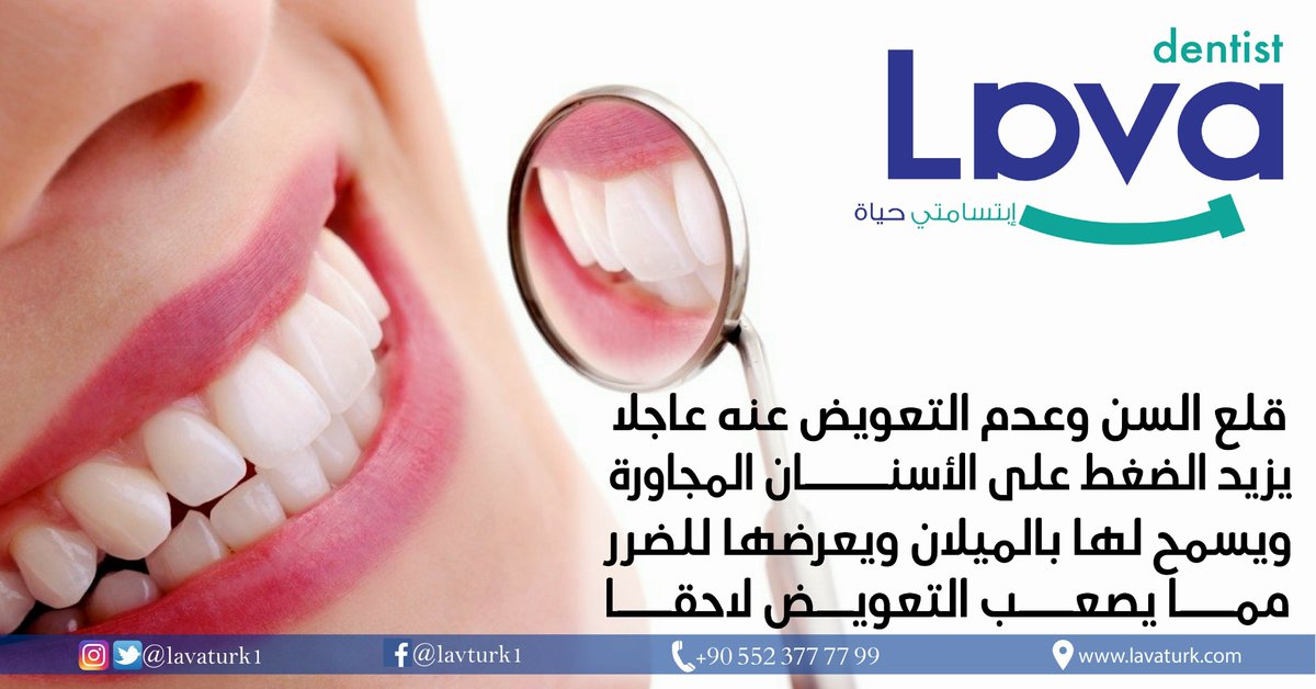 نحن في عيادة لافا نوصي بالإسراع في التعويض عن الأسنان المفقودة سواء بالزراعة أو عمل الجسور لحماية العظم والأسنان المجاورة
#عيادة_لافا_لطب_الأسنان
#إبتسامتي_حياة