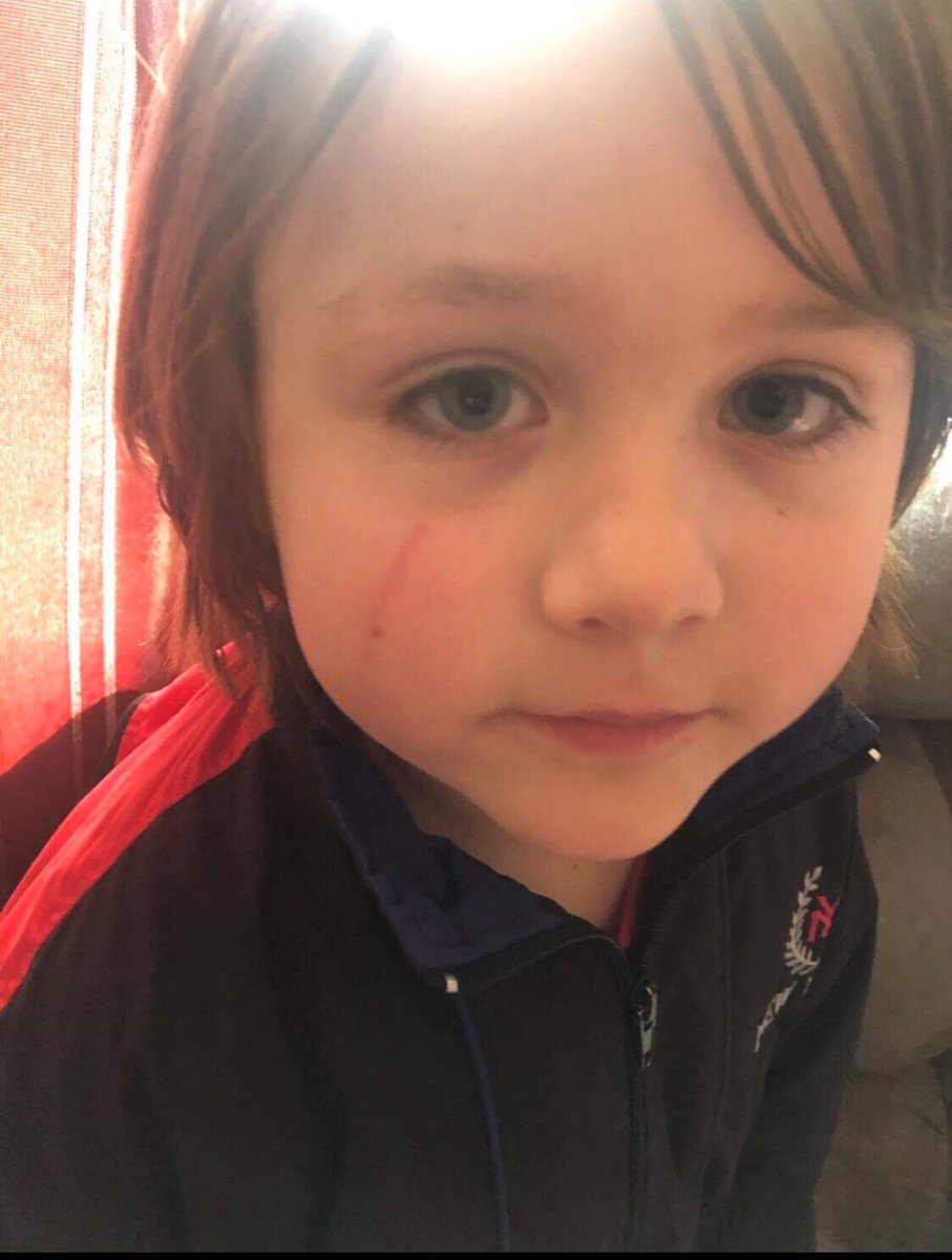 GeorgiaKTVL's tweet photo. Paxton, a kindergartener at Oak Grove Elementary, has been verbally and physically bullied in class. His mom says the teacher dismissed it as rough play. Now, she’s asking the school to step in and prioritize kindness - on the playground, in the classroom, and beyond. https://t.co/O51CujriIp