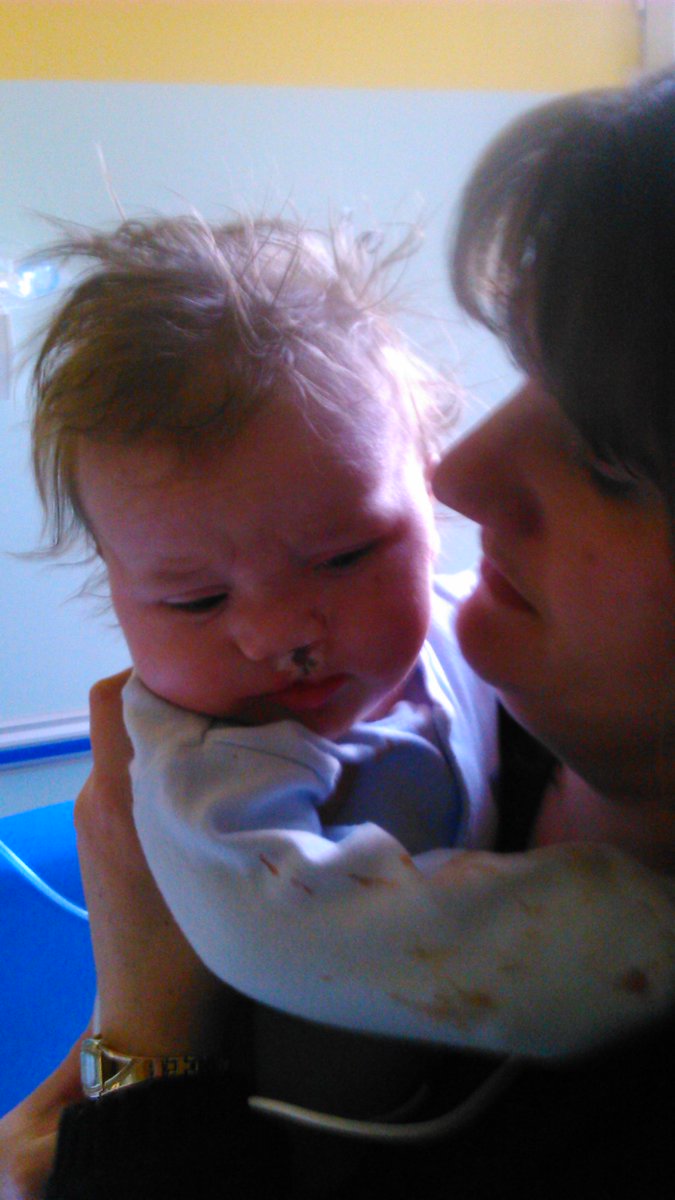 Andrew March (@marchypgagolf) on Twitter photo 5 years ago today <a href="/CLAPACOMMUNITY/">Cleft Lip and Palate Association</a> <a href="/ARMCobb/">Ali Cobb FRCS</a> !! #Logan #LipRepair #CleftProud 5 years ago today <a href="/CLAPACOMMUNITY/">Cleft Lip and Palate Association</a> <a href="/ARMCobb/">Ali Cobb FRCS</a> !! #Logan #LipRepair #CleftProud