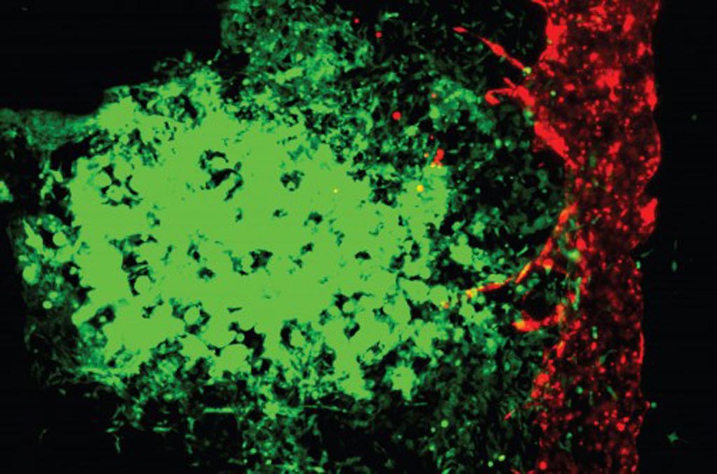 BiotechDailycom's tweet photo. Bioprinting Studies How Cancer Cells Grow and Spread:Novel use of a three-dimensional (3D) bioprinting technique... https://t.co/hY948DvHfr https://t.co/4HZucG7nJc