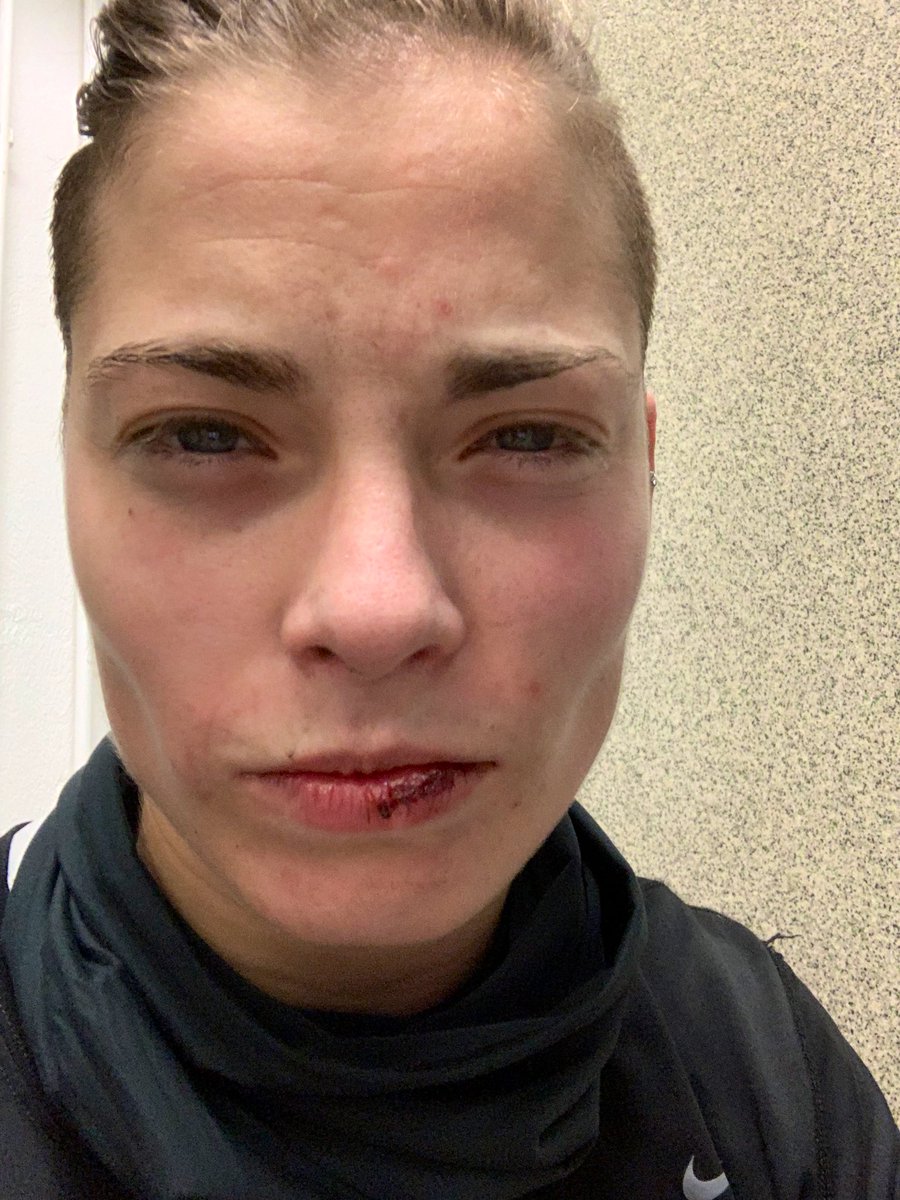 smalls_2thawall's tweet photo. Sometimes I save the ball with my face π€·π»ββοΈ #gkprobs https://t.co/a9GK3gjq45
