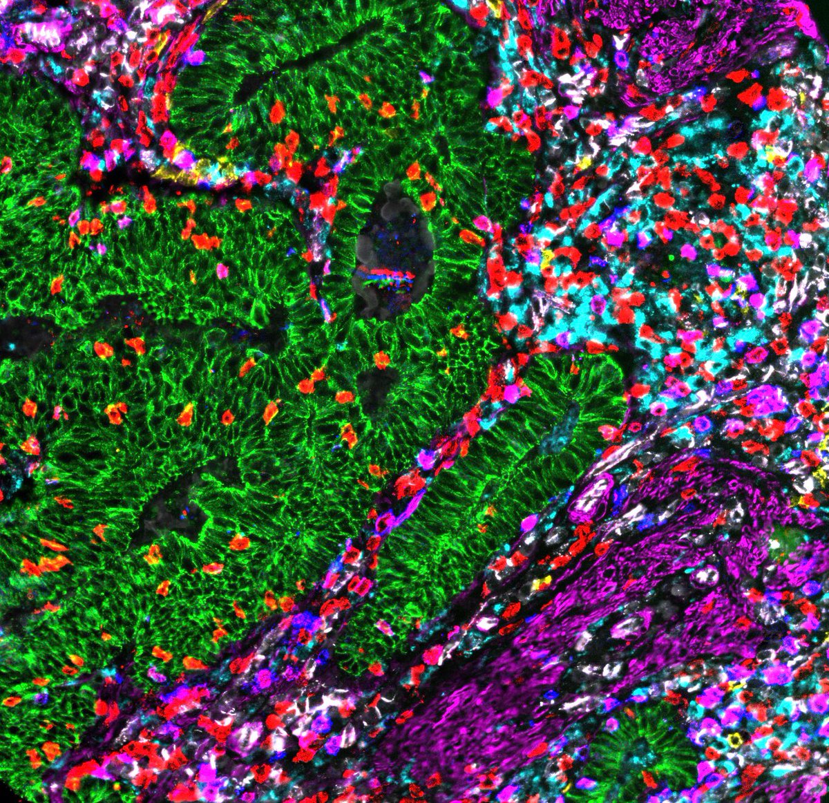 Fiona_Ginty's tweet photo. Great meeting in Houston on imaging-based #singlecellanalytics and presenting #CellDIVE platform and our #tumorheterogeneity research with @PBogetto and @dominika_lucas #GEResearch #GEHC #CancerResearch #coloncancer https://t.co/wT9OPYfrj8
