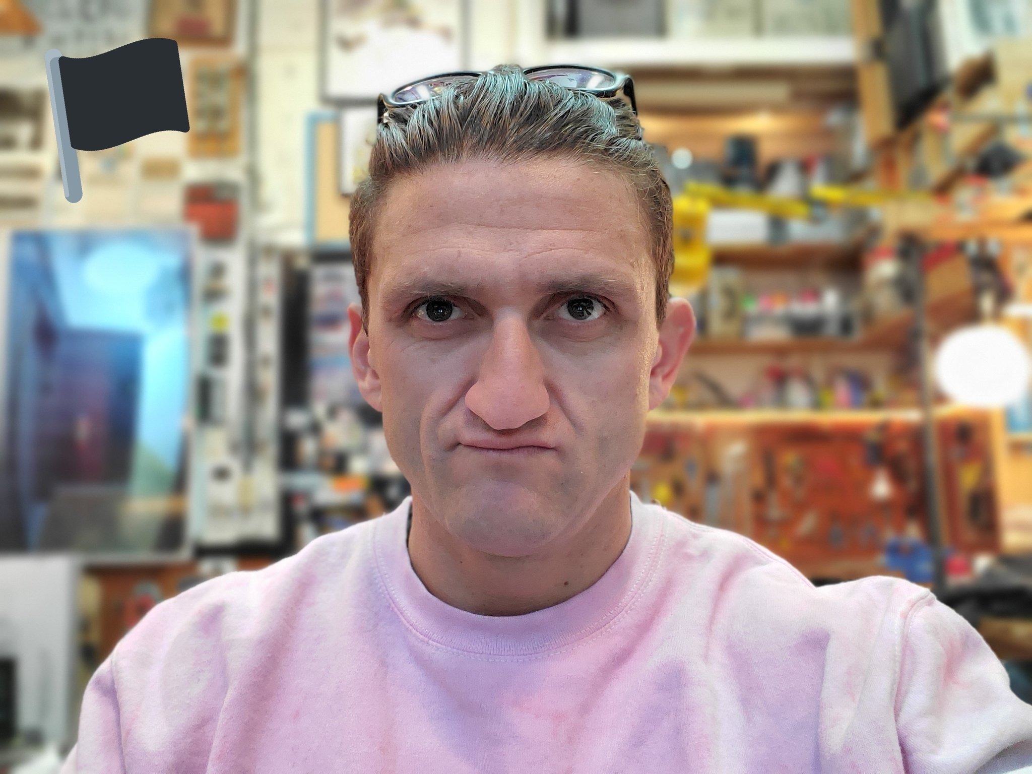 What Happened To Casey Neistat'S Face? Shocking Reveal!