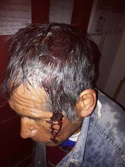 alertarojanot's tweet photo. Ahora ; Severa tormemta de Granizo Destructivo golpea el norte de Potosí #Bolivia 🇧🇴 , municipio #Colquechaca y #Chayanta) Destruyendo cultivos, matando aves de corral y dejando personas heridas #Imagenes https://t.co/m7j3GT7WDU