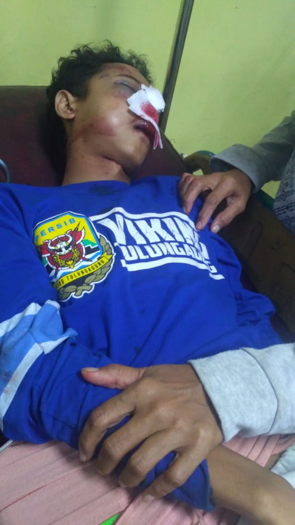 Viking_Blitar's tweet photo. Dalam waktu dekat Blitar akan menuju Tulungagung untuk menjenguk secara langsung kondisi mas Andre,
entah hari apa masih dikoordinasikan dengan pengurus namun yg jelas dalam minggu ini

Mari kita doakan semoga mas Andre bisa segera pulih dan kembali beraktivitas seperti semula 🙏 https://t.co/q9MiVs0W5v