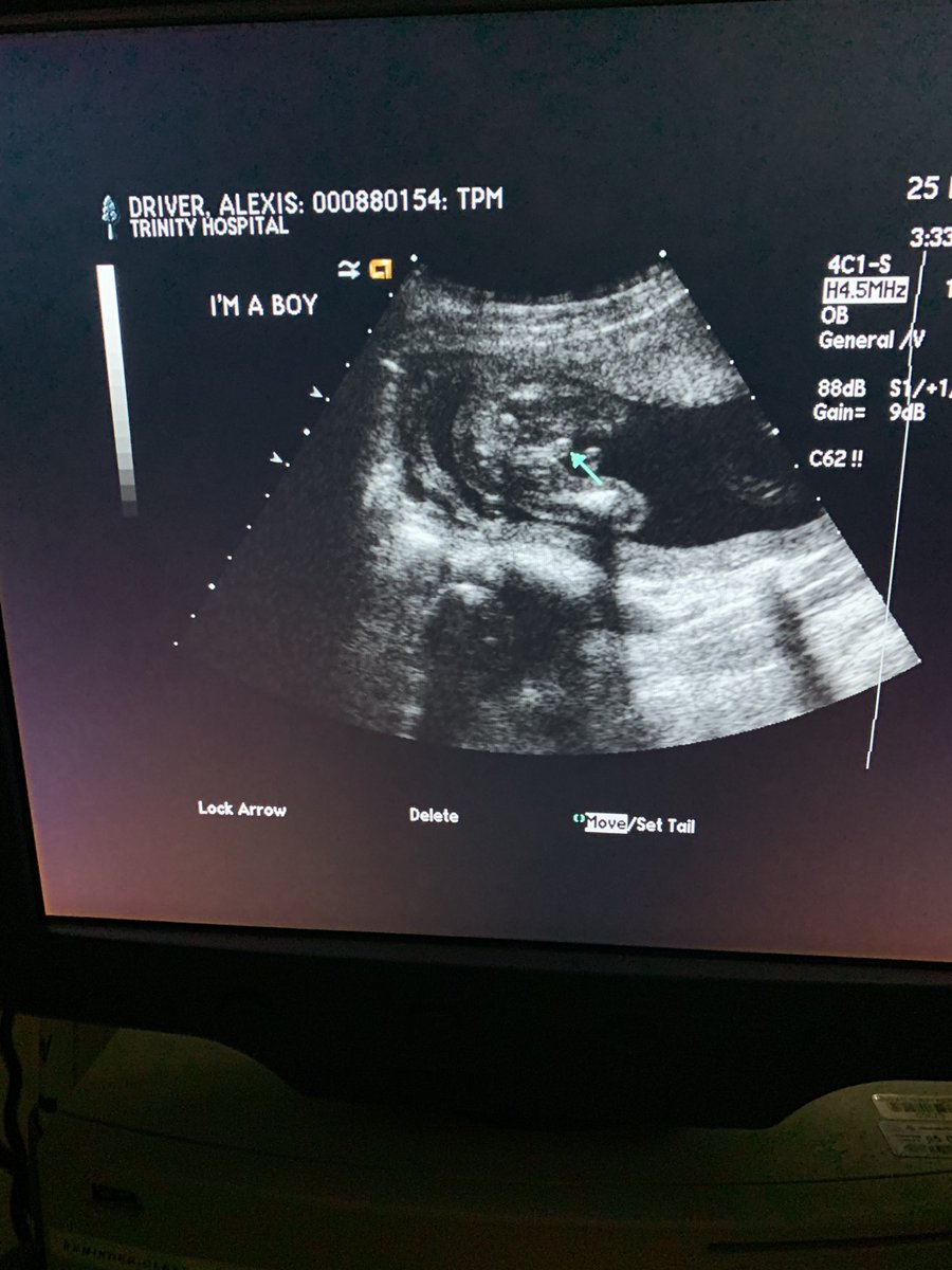 _Naheemah's tweet photo. It’s a boy y’all , I’m having a son 💙💙💙💙💙 https://t.co/YhHmlwxa5C