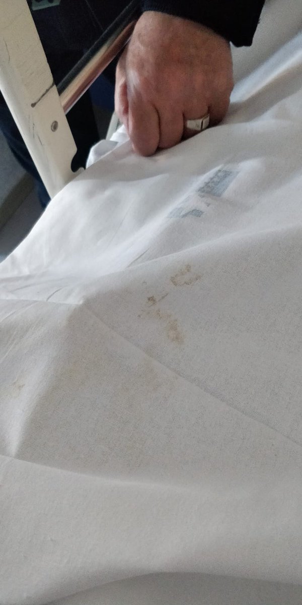 casicas7's tweet photo. Supuestamente esto son sábanas limpias y si protestas te dicen que todas estan igual. Sinceramente es vergonzoso. #porunasanidaddigna #hospitallaprincesa #madrid #saludmadrid #telemadrid #ministeriodesanidad #saludcmadrid #sanidadpublica https://t.co/lcalBc8u9Z