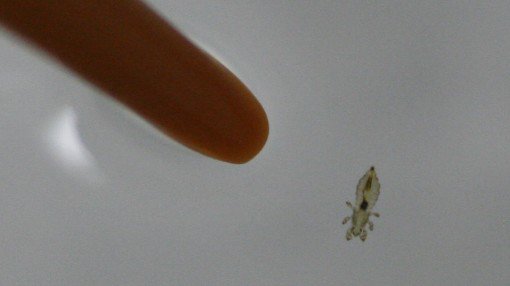 TND's tweet photo. Lice are everywhere: 'Highly contagious' cases up 30 percent nationwide. #CureLice @LiceNoMore
https://t.co/Jzm0a866kQ https://t.co/nQ6e26kQ0P
