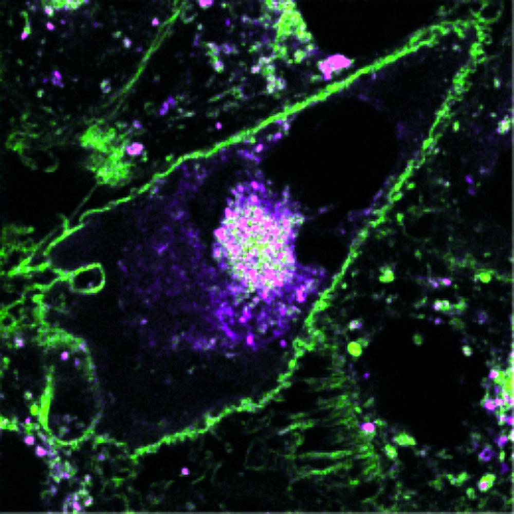 genoainstrument's tweet image. Hello there =). We are a #startup from @IITalk, pioneering new technologies in the field of #opticalmicroscopy. With @AD1959 and @VicidominiLab we are working on a new #superresolution #microscope based on #ImageScanningMicroscopy.