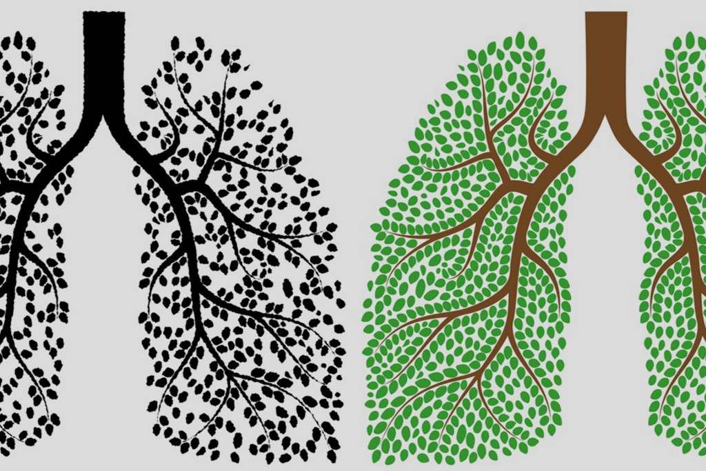 InternalMedical's tweet image. Did you know that you can periodically clean your lungs to get your breathing in order? Follow these methods to purge your lungs of the mucus that gets clogged and leads to chest congestion and inflammation: academiamag.com/simple-lung-cl…