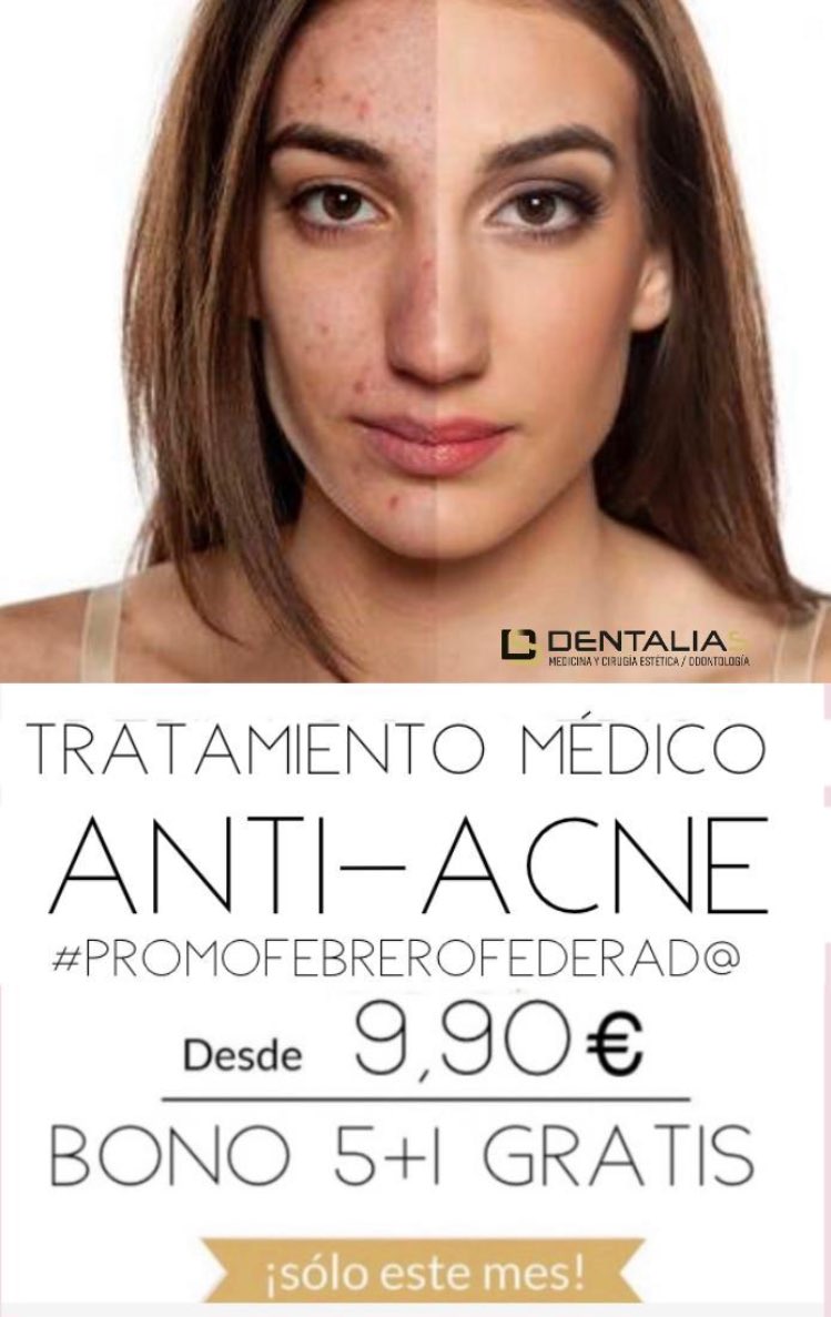 RFCF_es's tweet photo. Últimos días para aprovecharte de la #PromoFebrero en @CDentalias, nuestra clínica oficial ¡🙄💸!
➡️ Depilación médica LÁSER
➡️ Tratamiento médico anti-acné
Y muchas ofertas más... ¡INFÓRMATE! ¡📞! https://t.co/0a99JSBNzj