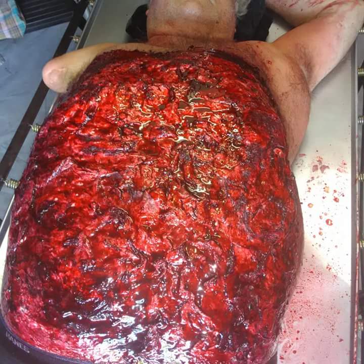 RealSamMason's tweet photo. #sacrificialpawnproductions and #stonemasonsfx creates some of the most #hyper #realistic #sfxprops this #prop was created for #normal_terror_themovie Our process saves time and thus saving #budget getting your props on #set sooner... https://t.co/ex5ELwBXbT