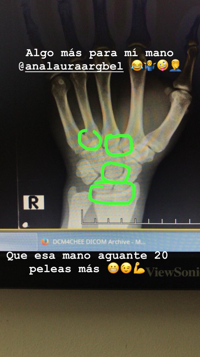 pitufoviera's tweet photo. 20 peleas más y soy feliz 😉🤷‍♂️🤪. https://t.co/9d2pf2MHUP
