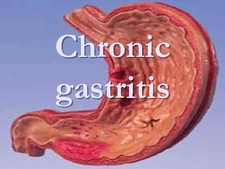 Como se cura una gastritis cronica